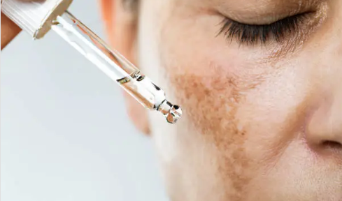 Why Tranexamic Acid Is the Breakout Brightening Ingredient for U.S. Skin in 2025
